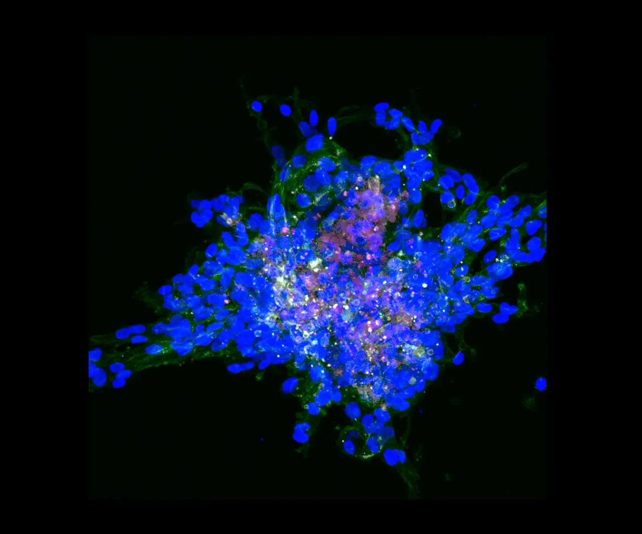 Three-dimensional fluorescence reconstruction of invasive breast cancer cells grown in a tissue-like matrix