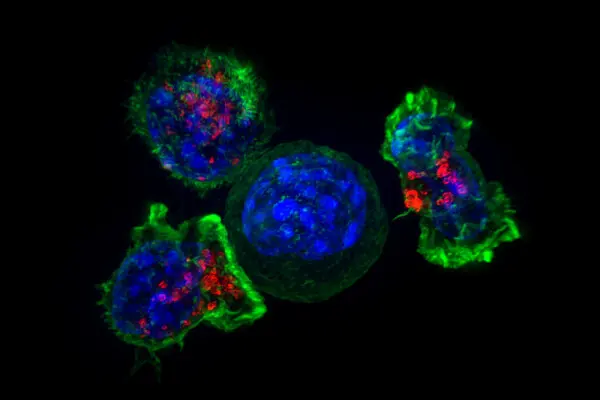 Fluorescence microscopy image of killer T cells surrounding a cancer cell