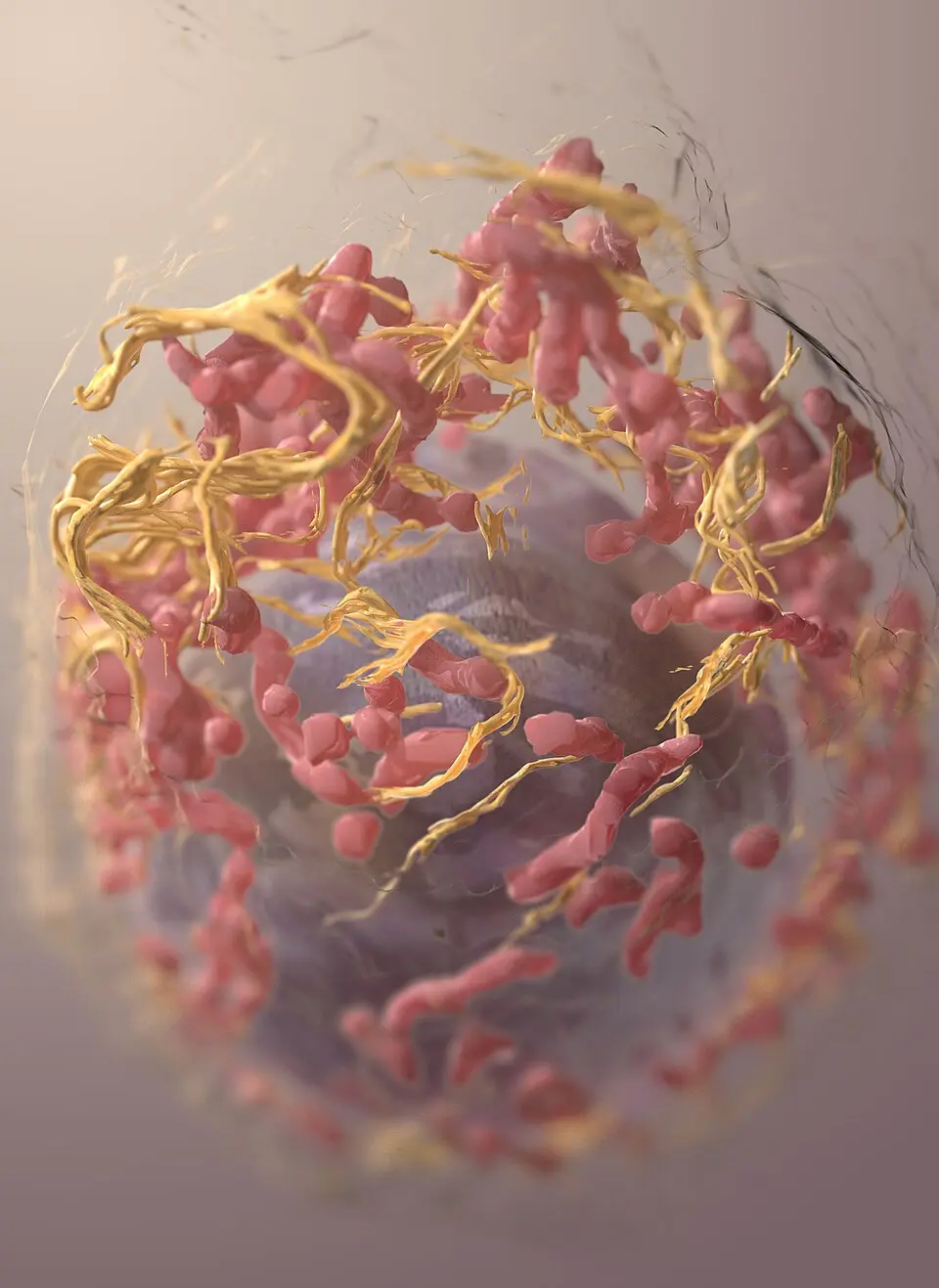 Three-dimensional structure of a melanoma cell reconstructed with ion-abrasion scanning electron microscopy