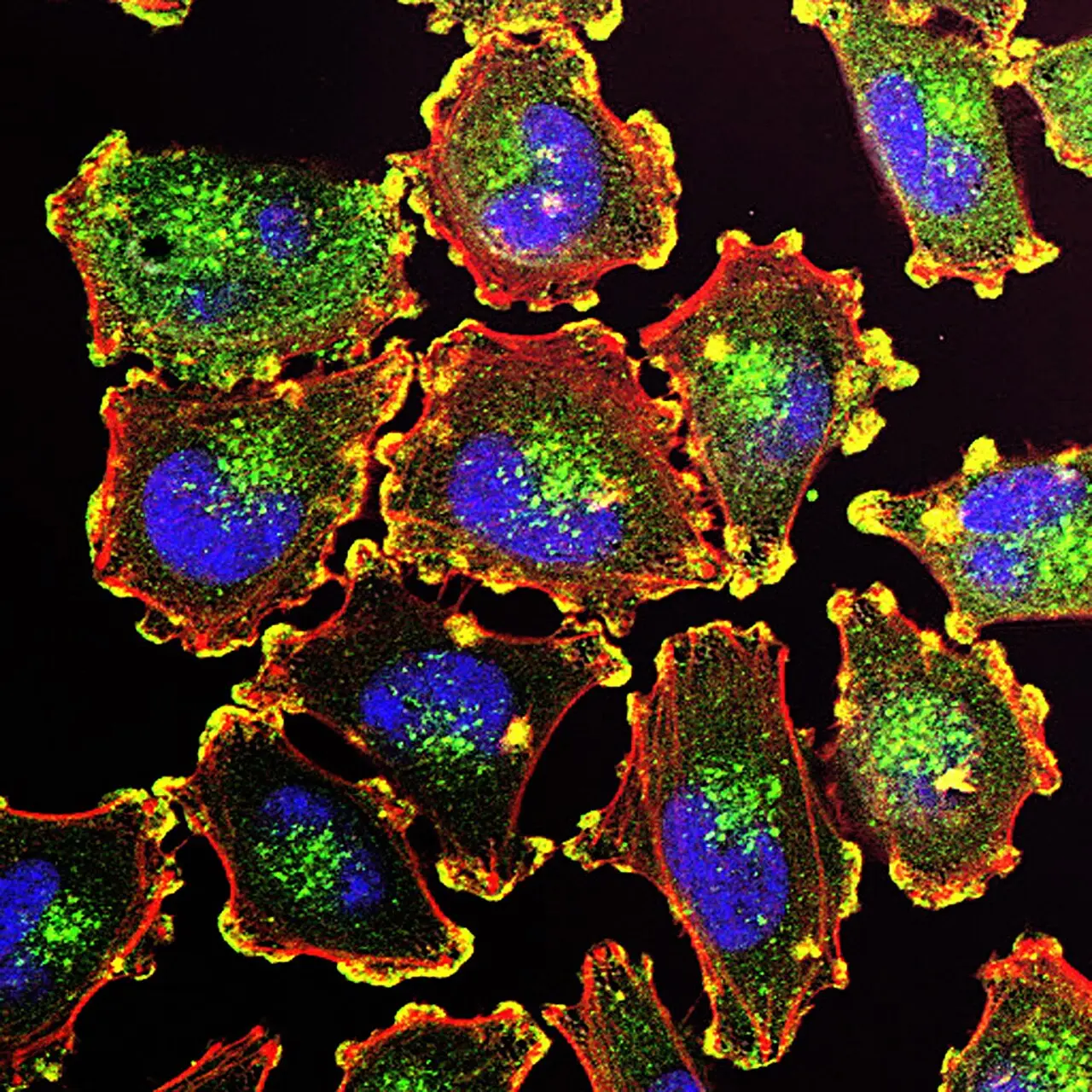 Fluorescence image of metastatic melanoma cells with blue nuclei and multicolored actin structures
