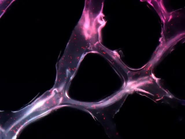 Electron microscopy image of a branched artificial microRNA delivery scaffold