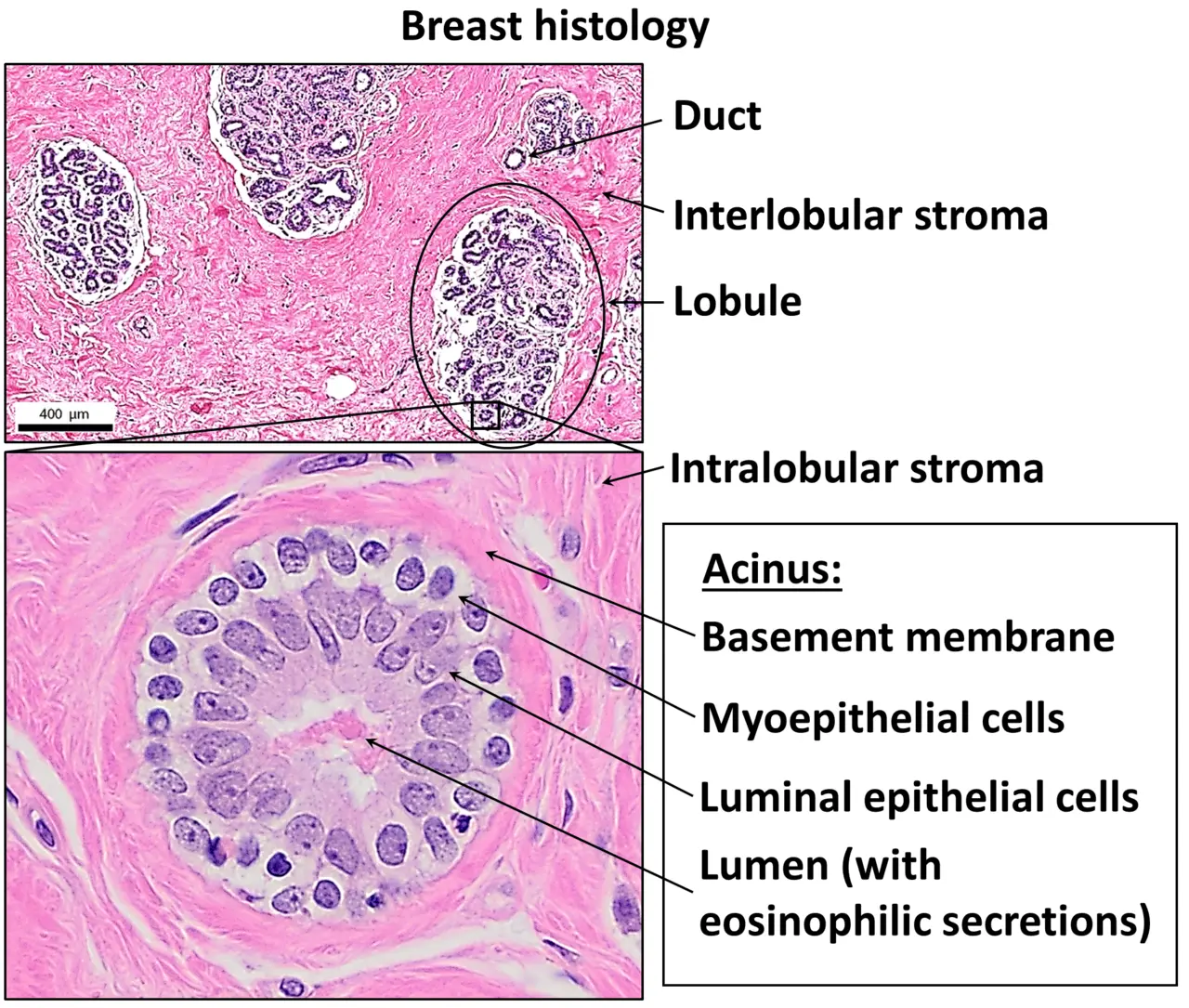 H and E stained normal breast tissue showing organized ducts, lobules, and an acinus