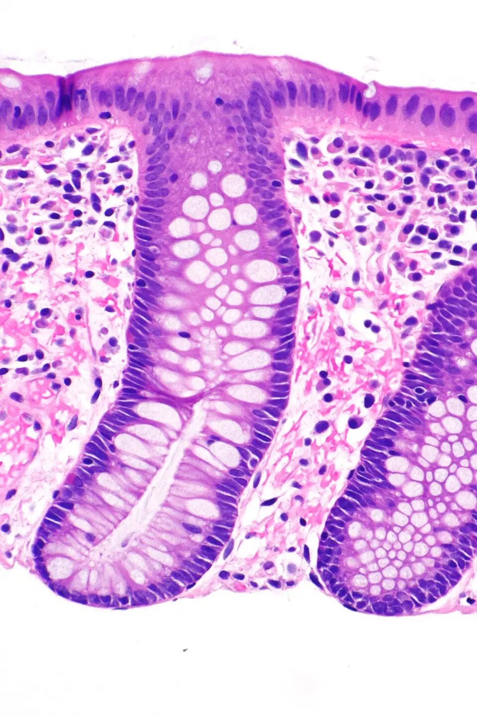 H and E stained normal colorectal mucosa at high magnification