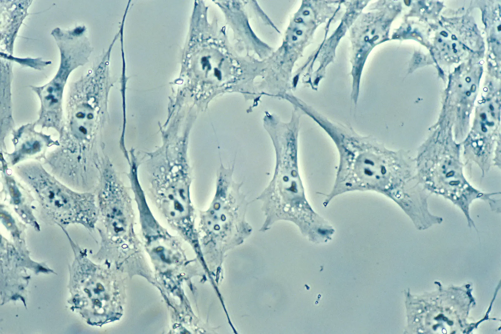 Normal human connective-tissue cells in culture using darkfield amplified contrast