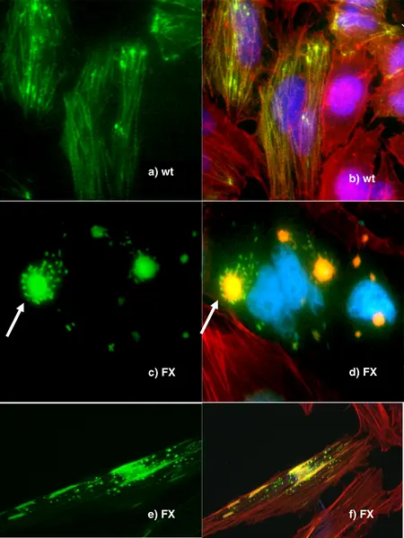 Fluorescence microscopy panels comparing palladin constructs in cultured HeLa cells