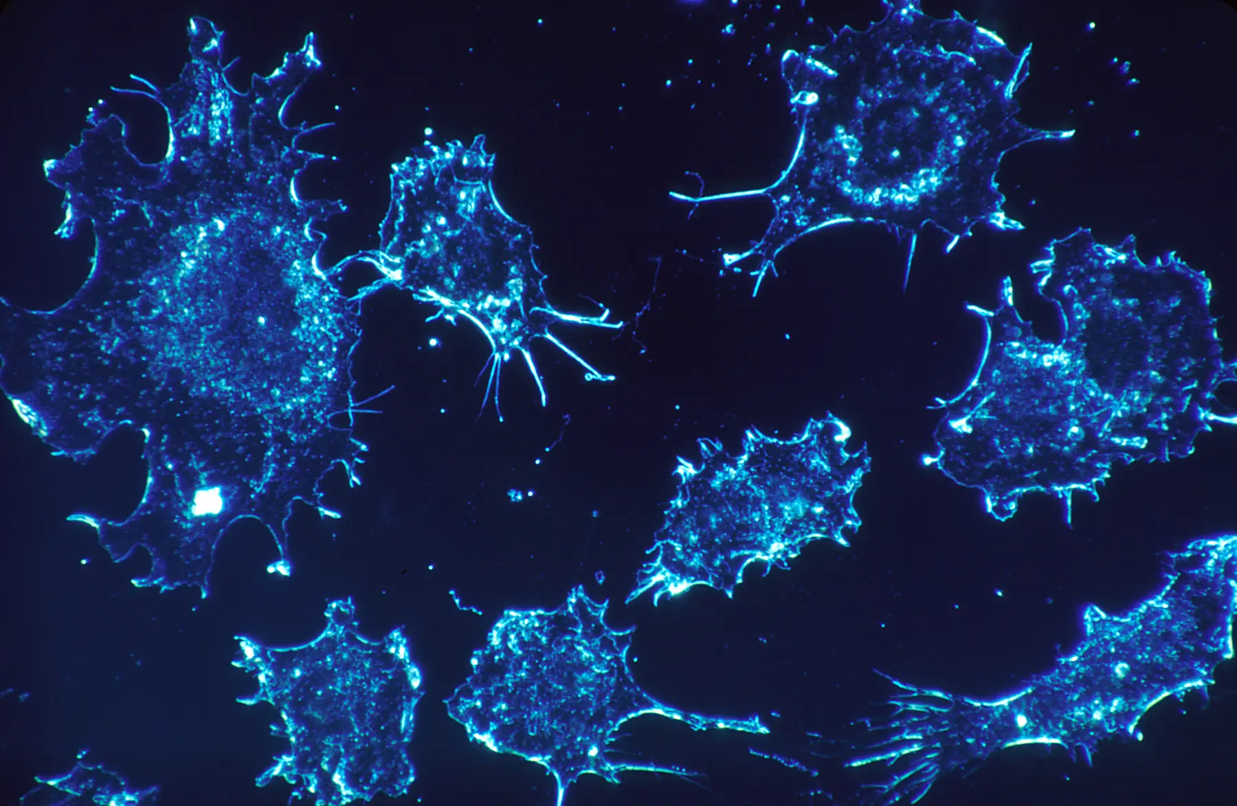 Cancer cells in culture under darkfield amplified contrast