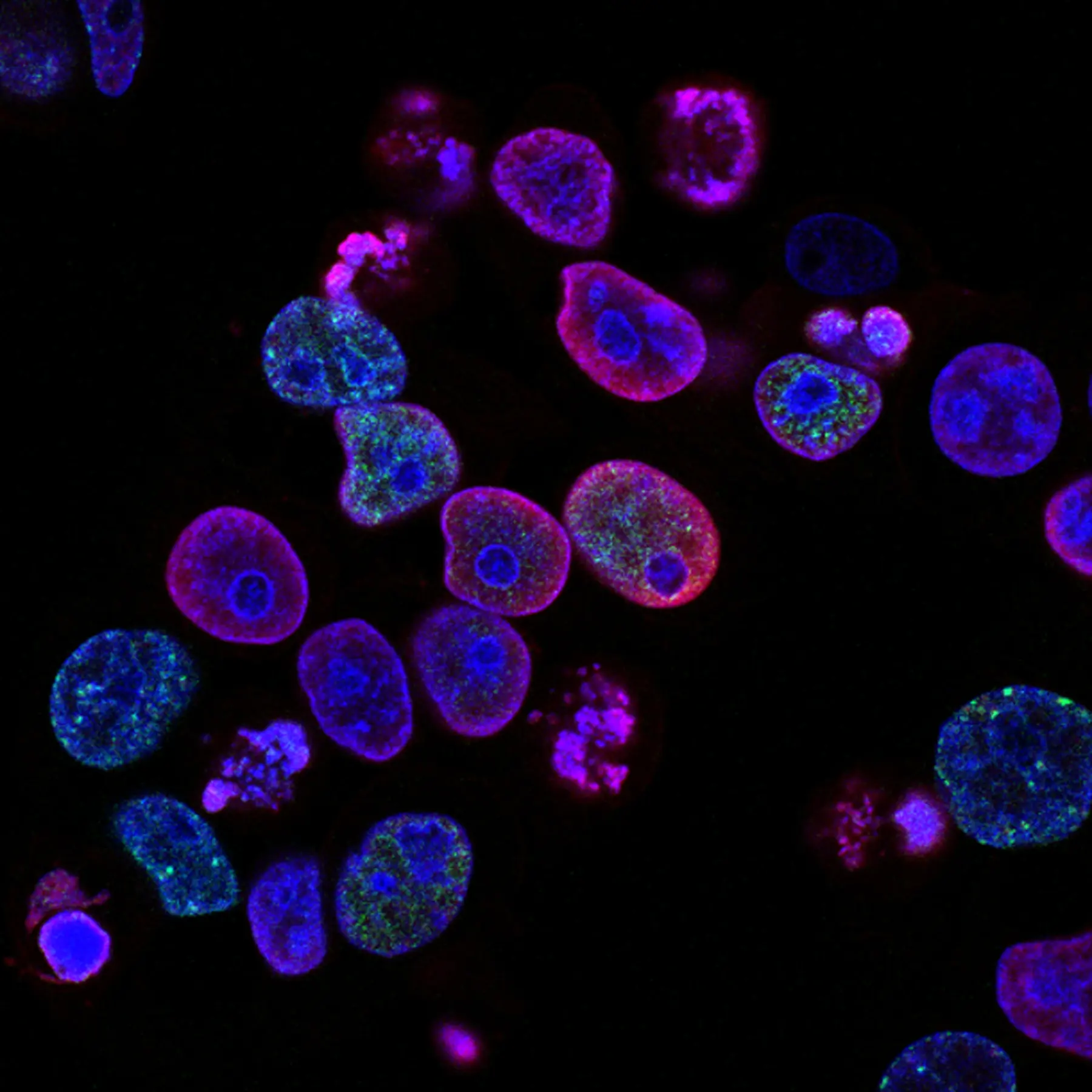 Fluorescent microscopy image of human colorectal cancer cells